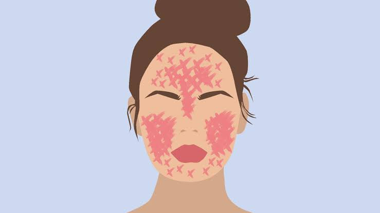 The Rise of Anti-Inflammatory Skincare: A Path to Calmer, Healthier Skin